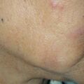 misuse_pm010611.jpg
