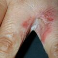 misuse_pm010807.jpg