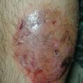 misuse_pm020715-1.jpg