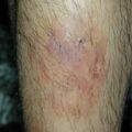 misuse_pm020715-2.jpg