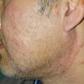 misuse_preca020705-1.jpg
