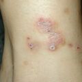 misuse_preca020729-1.jpg