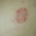 misuse_preca020729-2.jpg