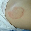misuse_preca020729-21.jpg