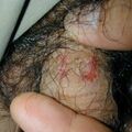 misuse_preca020809.jpg