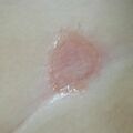 misuse_preca020812-1.jpg