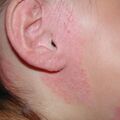 misuse_preca020816-1.jpg