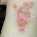 misuse_predi010917-1.jpg