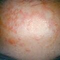 misuse_predni9-903.jpg