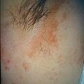 misuse_presol9-378.jpg