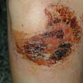 misuse_propolis010830-1.jpg