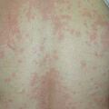 misuse_rhus020425-2.jpg