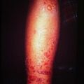 misuse_rhus2000-401.jpg