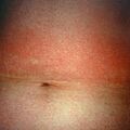 misuse_rhus9-409.jpg