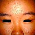 misuse_saerogenta9-527.jpg