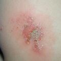 misuse_saerone020720.jpg