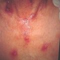 misuse_salicyate9-969.jpg