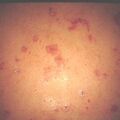 misuse_salicyate9-970.jpg
