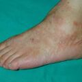 misuse_salt010730-1.jpg
