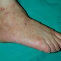 misuse_salt010730-2.jpg