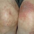 misuse_saltstupe020330-2.jpg