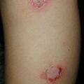misuse_semasol010730-1.jpg