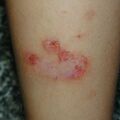 misuse_semasol010730-2.jpg