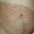 misuse_serna020613-1.jpg