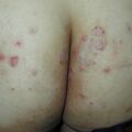 misuse_serna020719.jpg