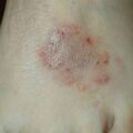 misuse_silkrong020906.jpg