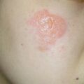 misuse_silmazin020506.jpg