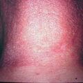 misuse_sinsin2000-110.jpg