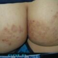misuse_solcoseryl020525.jpg