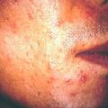 misuse_sterocin-g2000-254.jpg
