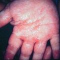 misuse_sterocing2000-389.jpg