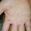 misuse_steroid010724-1.jpg