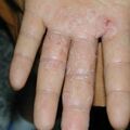 misuse_steroid010724-2.jpg