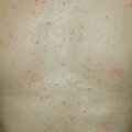 misuse_steroid0205010-1.jpg