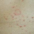 misuse_steroid0205010-2.jpg