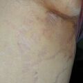 misuse_steroid020509.jpg
