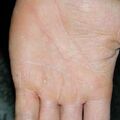 misuse_steroid020626-2.jpg