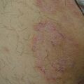 misuse_steroid020626-3.jpg