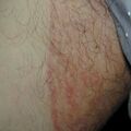 misuse_steroid020715.jpg