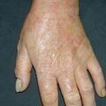 misuse_steroid020725-2.jpg