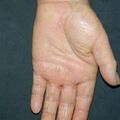 misuse_steroid020725-3.jpg