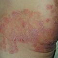misuse_steroid020727.jpg
