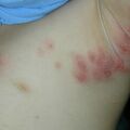 misuse_steroid020807.jpg