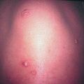 misuse_steroid2000-209.jpg