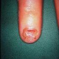 misuse_steroid2000-214.jpg
