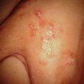 misuse_steroid2000-293.jpg
